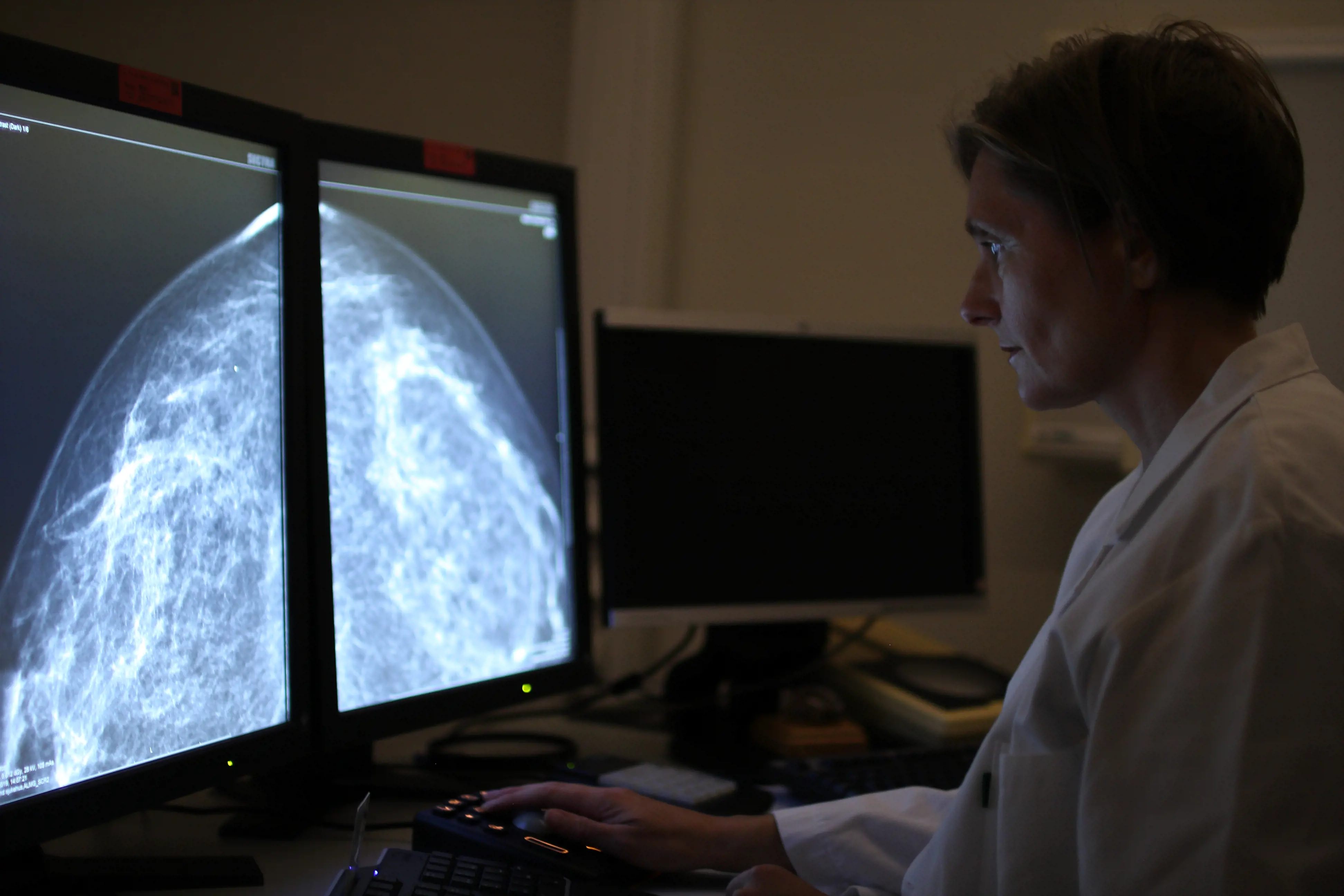 Solveig Roth Hoff tyder mammografibilete